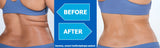 Coolsculpting Sale + Additional $350 Back on packages