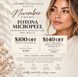 Laser MicroPeels $100-$140 off!