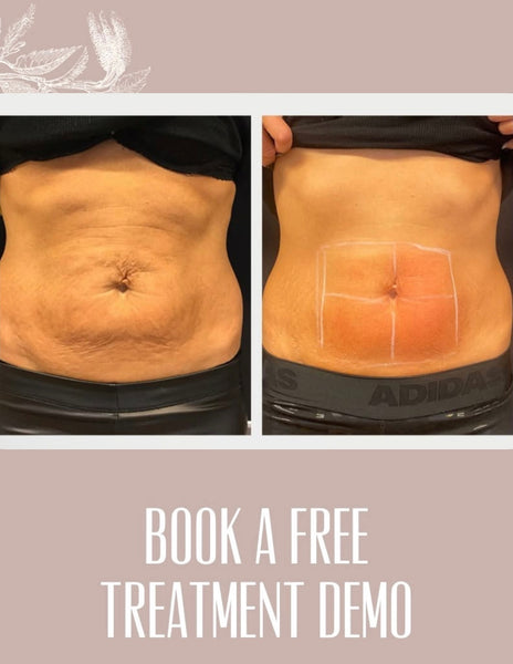 FREE Treatment DEMO • BodySculpting *NOT A FULL TREATMENT*