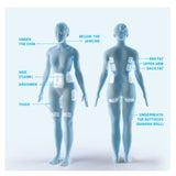 Coolsculpting