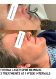 FREE Treatment Demo
