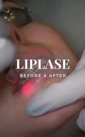 LipLase Plumping Treatment