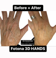 FREE Treatment Demo