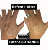 FREE Treatment Demo