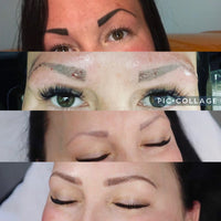 FREE Treatment Demo