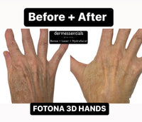 FREE Treatment Demo